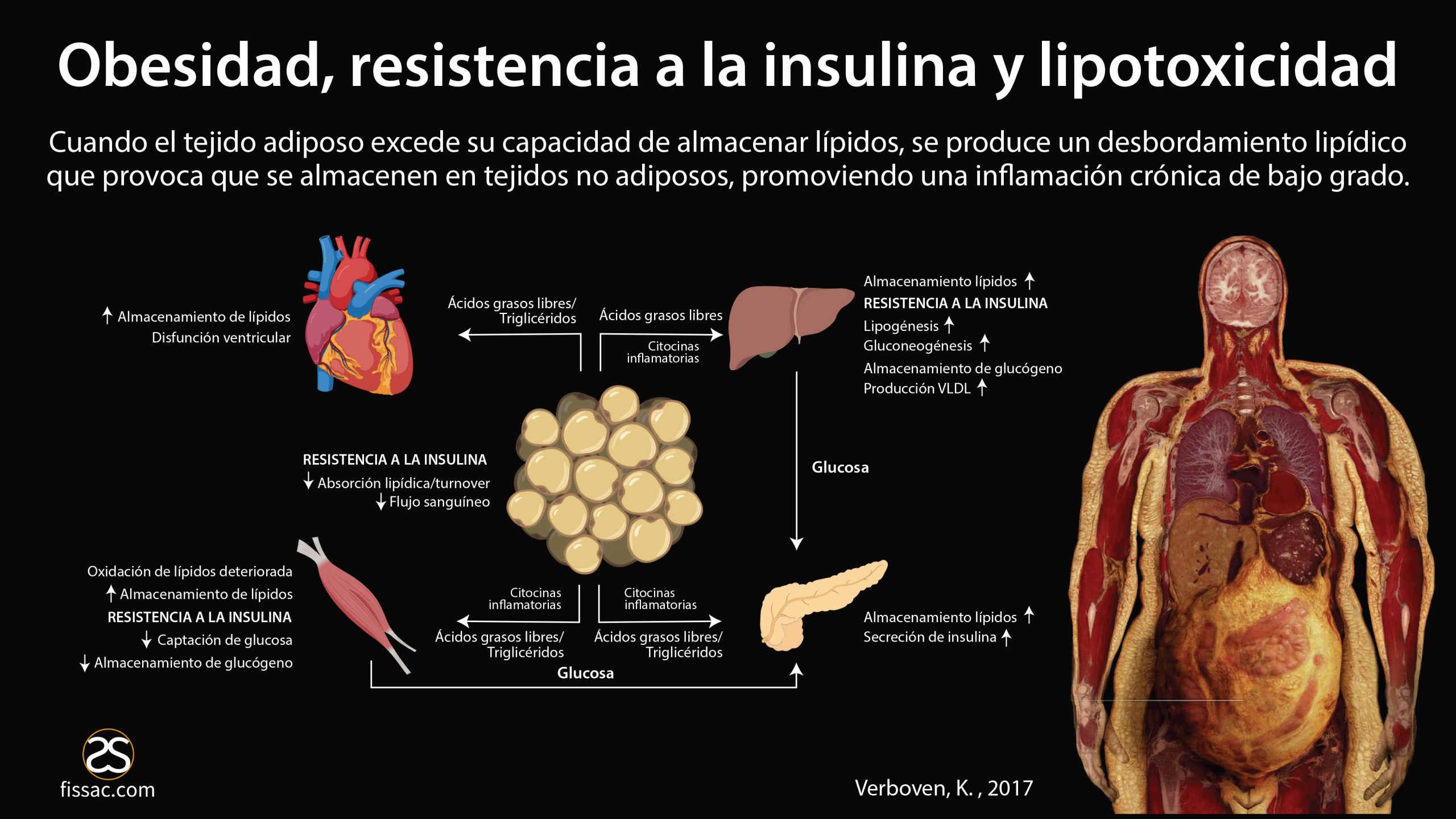La cetosis mejora la resistencia a la insulina