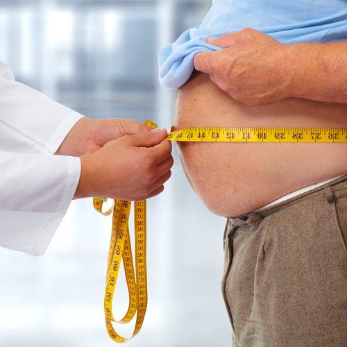 Fissac_La obesidad- un gran problema para los sistemas sanitarios