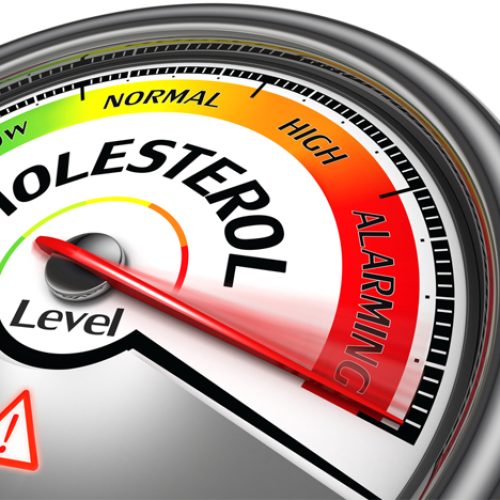 fissac_colesterol niveles