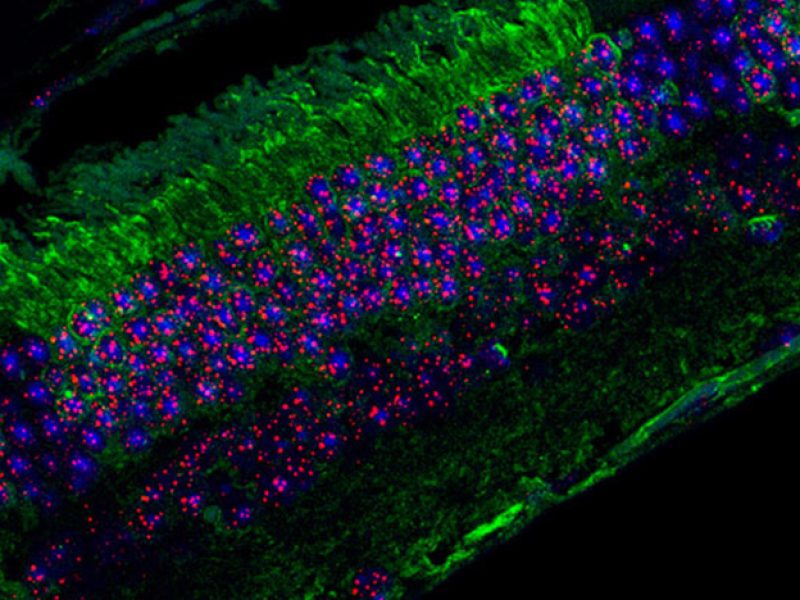 fissac_hiperlargos telómeros